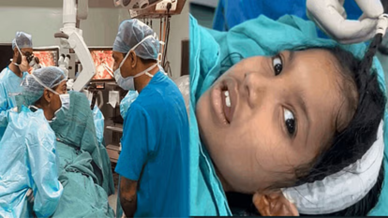 बिना बेहोश किए दिल्ली AIIMS में 5 साल की बच्ची की हुई ब्रेन सर्जरी, सर्जन का दावा- दुनिया में पहला ऐसा मामला